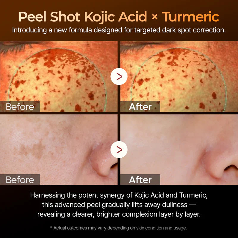 Dr Melaxin Kojic Acid Exfoliating Turmeric Spray™