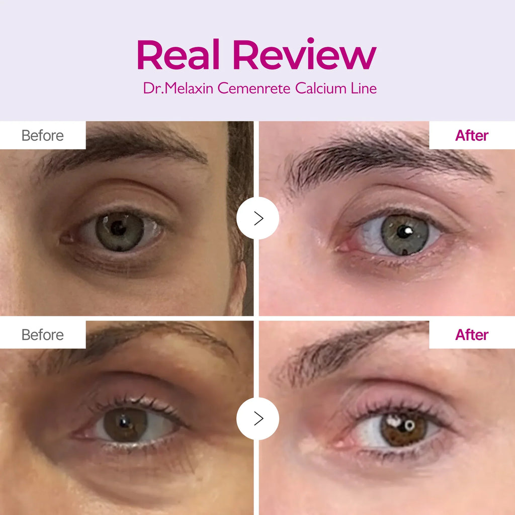 Calcium Eyecare Routine Set