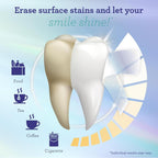 Teeth Whitening Strips - 7-Day Treatment with -Non-Slip Dry Technology for Comfort & Contact