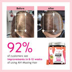 Biotin Gummies for Hair Skin & Nails. 5000 mcg High Potency Vegan Vitamins fo...